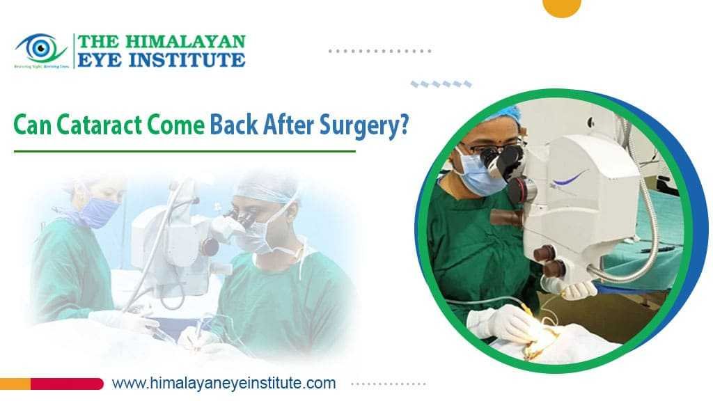 Cataract Surgery
