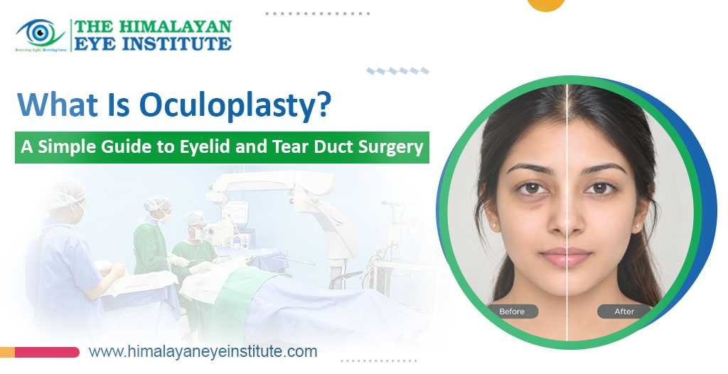 Oculoplasty Surgery