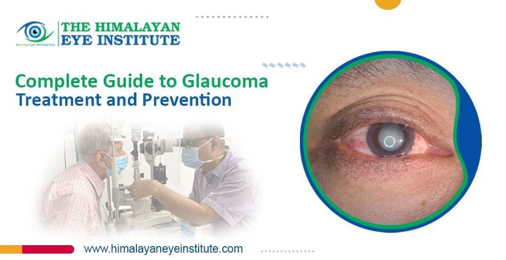 Glaucoma Treatment