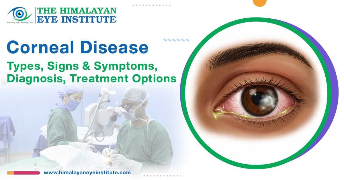 Corneal Disease
