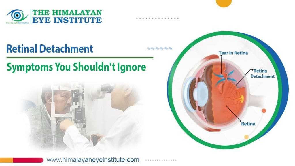 Retinal Detachment