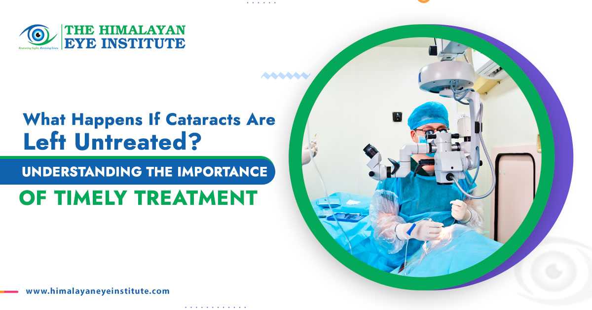 What Happens If Cataracts Are Left Untreated? Understanding the Importance of Timely Treatment