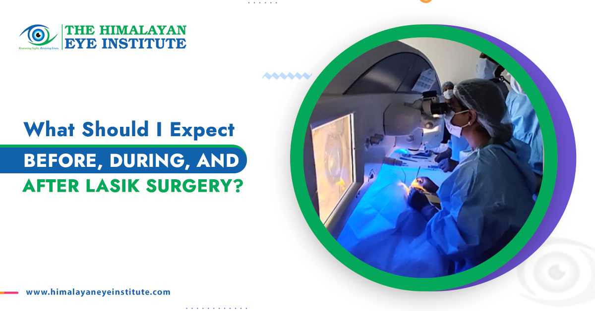 What Should I Expect Before, During, And After LASIK Surgery?