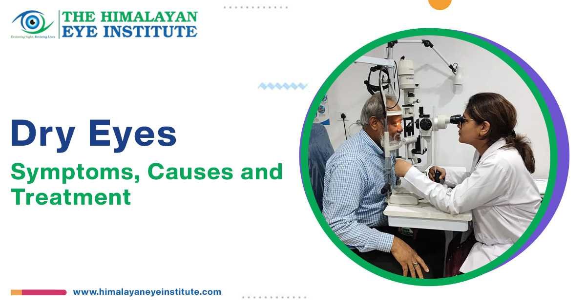 Dry Eyes: Symptoms, Causes and Treatment