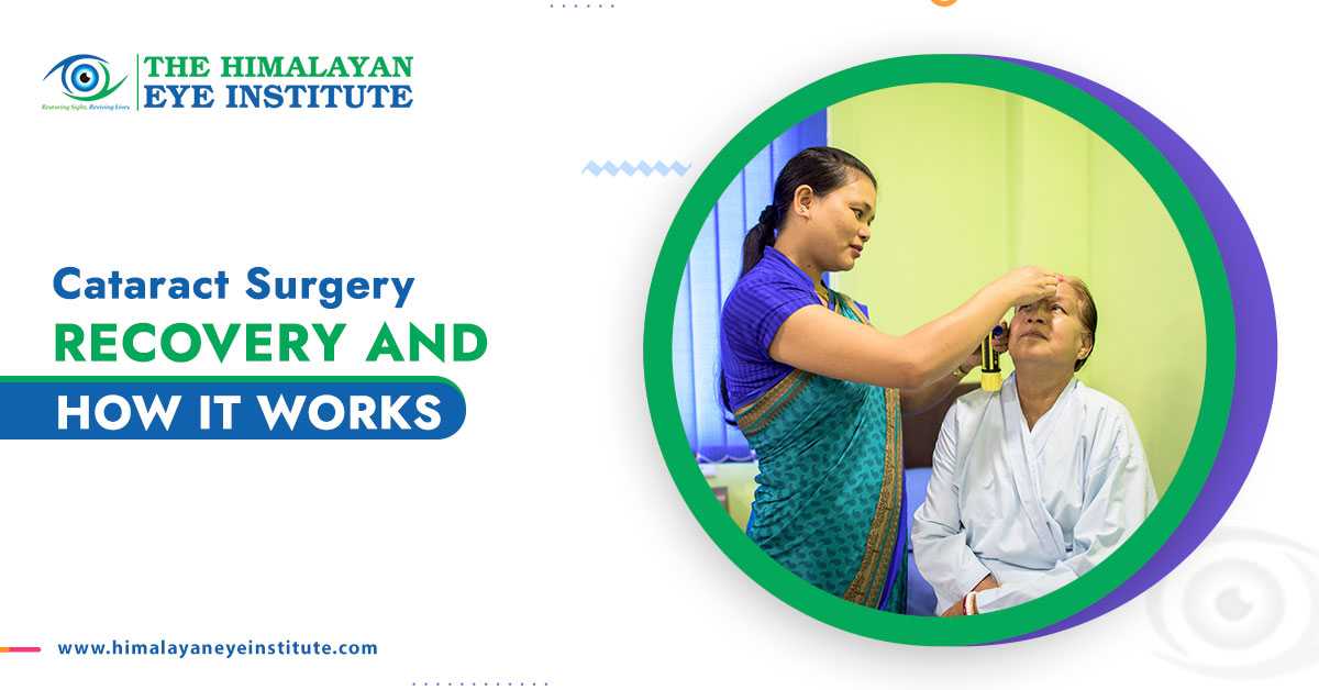 Cataract Surgery: Recovery and How It Works
