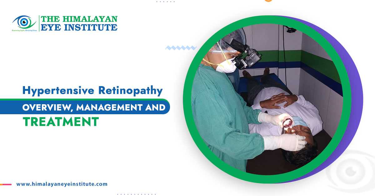 Hypertensive Retinopathy: Overview, Management, and Treatment